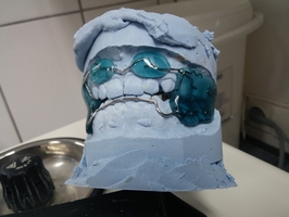 Вижте Dental Implants 23