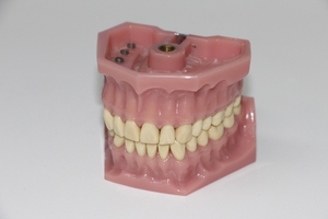 Голямо разнообразие Dental Implants 34