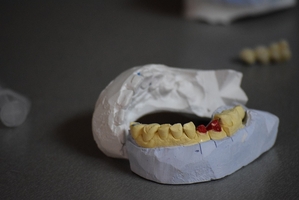 Ефектни Dental Implants 35