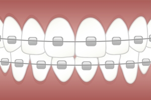 Разнообразие от Dental Implants 36
