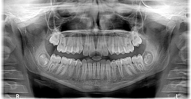 Разгледайте Dental Implants 38
