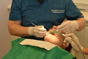 Намерете Dental Implants 4