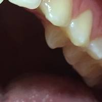 Огромно разнообразие от естетично реконтуриране 8 от MedicalDent Огромно разнообразие от естетично реконтуриране 8