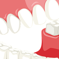 Качествени фасети цени 11 от MedicalDent Качествени фасети цени 11