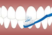 Вземете фасети цени 13 от MedicalDent Вземете фасети цени 13