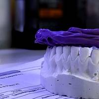 Намерете най-добрите оферти за фасети цени 21 от MedicalDent Намерете най-добрите оферти за фасети цени 21