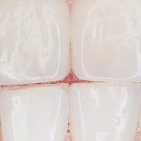 Каталог фасети цени 34 от MedicalDent Каталог фасети цени 34