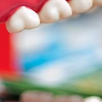 Изберете нашите фасети цени 37 от MedicalDent Изберете нашите фасети цени 37