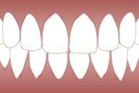 Голямо разнообразие фасети цени 5 от MedicalDent Голямо разнообразие фасети цени 5