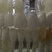Каталог фасети цени 9 от MedicalDent Каталог фасети цени 9