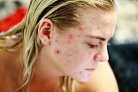 Изберете хайфу лифтинг 7 от DermaVita Изберете хайфу лифтинг 7