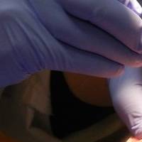 Типове имплантология 28 от MedicalDent Типове имплантология 28