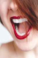 Оферти за Ортодонтско лечение 1 от The Smile Company Оферти за Ортодонтско лечение 1