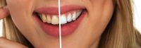 Информация за Ортодонтско лечение 12 от The Smile Company Информация за Ортодонтско лечение 12