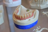 Типове Ортодонтско лечение 41 от The Smile Company Типове Ортодонтско лечение 41