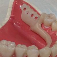 Информация за пародонтит 24 от MedicalDent Информация за пародонтит 24