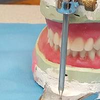 Вижте каталога ни с зъбни протези 15