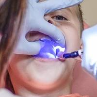 Оферти за зъбни протези 3