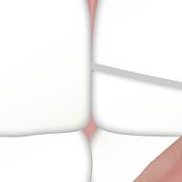 Оферти за ортодонт софия 18 от DsDent Оферти за ортодонт софия 18