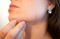 Огромно разнообразие от премахване на целулит 17 - DermaVita Огромно разнообразие от премахване на целулит 17