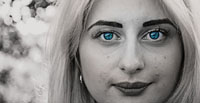 Вижте радиочестотен лифтинг 23 - DermaVita Вижте радиочестотен лифтинг 23