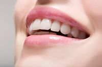 Invisalign - 75538 вида