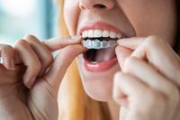 Invisalign - 52405 промоции