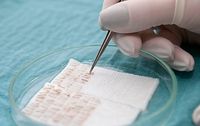 уголемяване на бюст - 60277 предложения