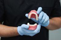 зъбни импланти - 19367 оферти | Dentalcare зъбни импланти - 81094 оферти