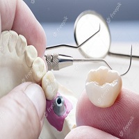 циркониева коронка цена - 70412 предложения