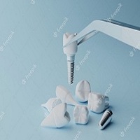 циркониева коронка цена - 93145 отстъпки