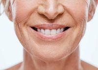 брекети цени - 40382 селекции | Dentalcare брекети цени - 93878 селекции