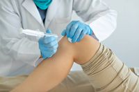 стволови клетки мнения - 86573 постижения | Bioregeneration стволови клетки мнения - 2225 постижения