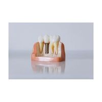 мезотерапия Варна - 51409 цени | Dental Club мезотерапия Варна - 44009 цени