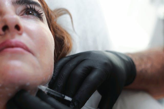 филъри за лице - 63225 цени филъри за лице - 15702 цени